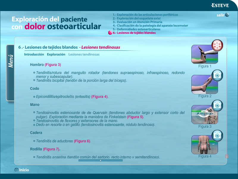 Exploración paciente dolor osteoarticular - 6