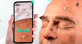 Actinic Keratosis Augmented Reality
