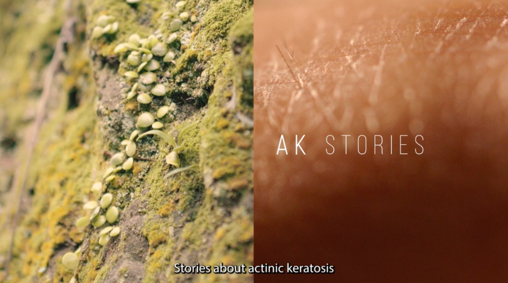 AK STORIES - 2