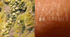 AK STORIES