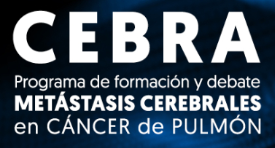 CEBRA Metástasis Cerebrales en Cáncer de Pulmón