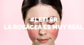 LETISR: La Rosácea es muy real