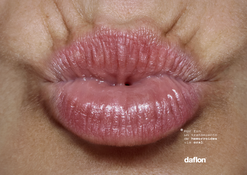 Tratamiento Oral - 3