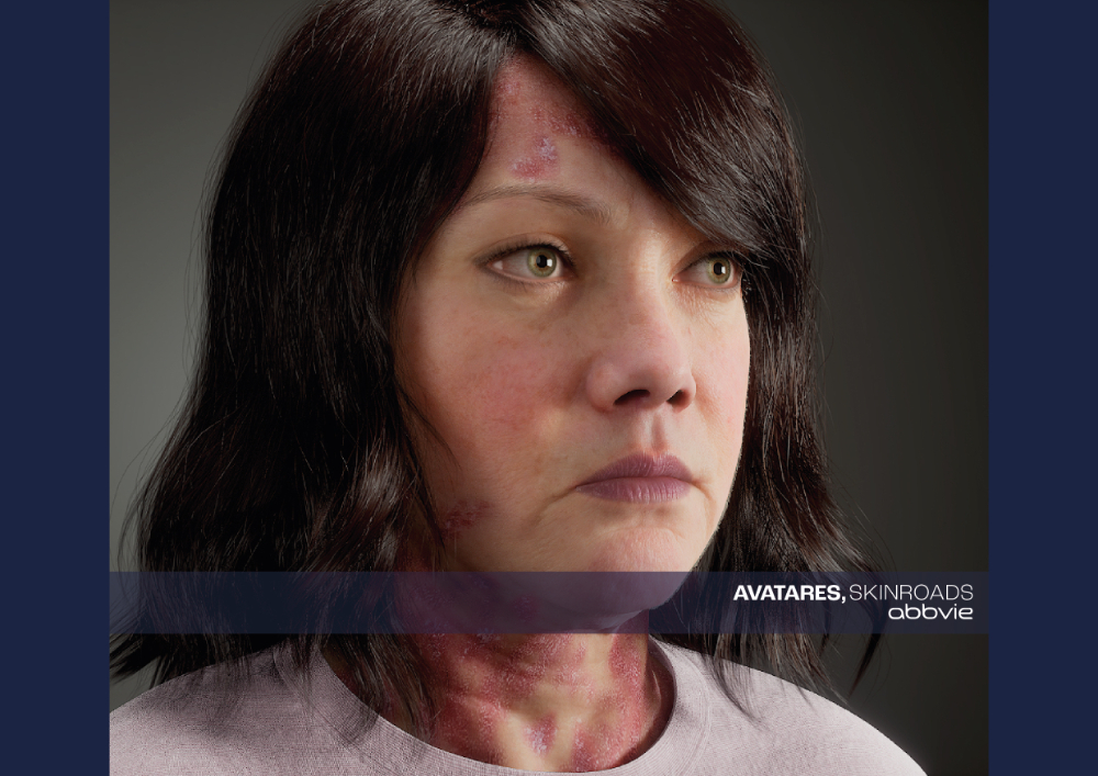 Avatares Skinroads: Cómo humanizar un caso clínico - 3