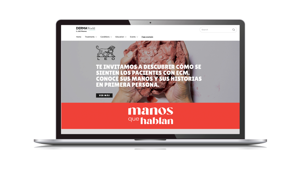 ECM: Manos que Hablan - 2