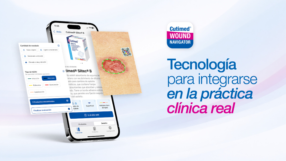 Cutimed Wound Navigator: Cada herida es única - 2