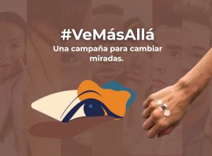 Campaña Ve Más Allá en Vitíligo - 2
