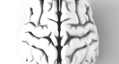 Cerebro