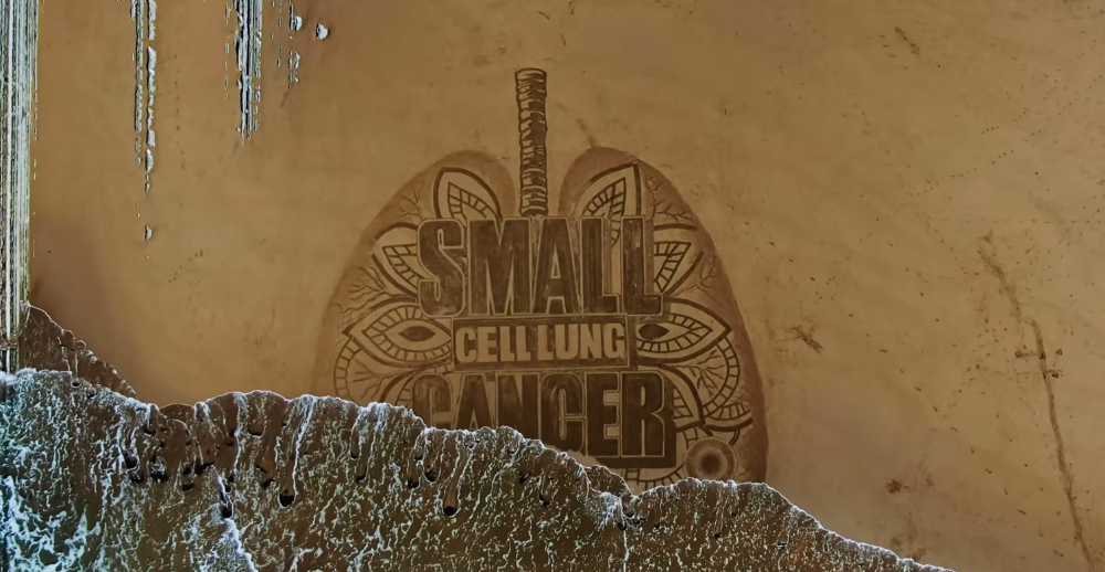 Small Things Matter - 4