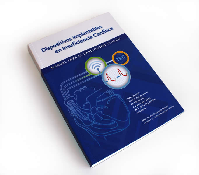 Dispositivos implantables en IC - 1