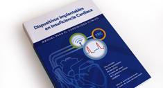 Dispositivos implantables en IC