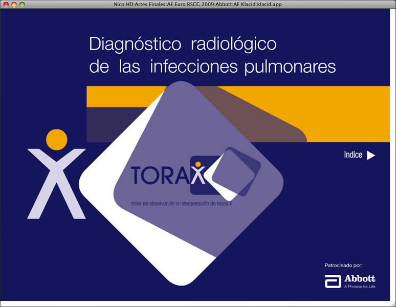 Torax - 2