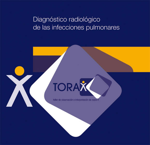Torax - 7