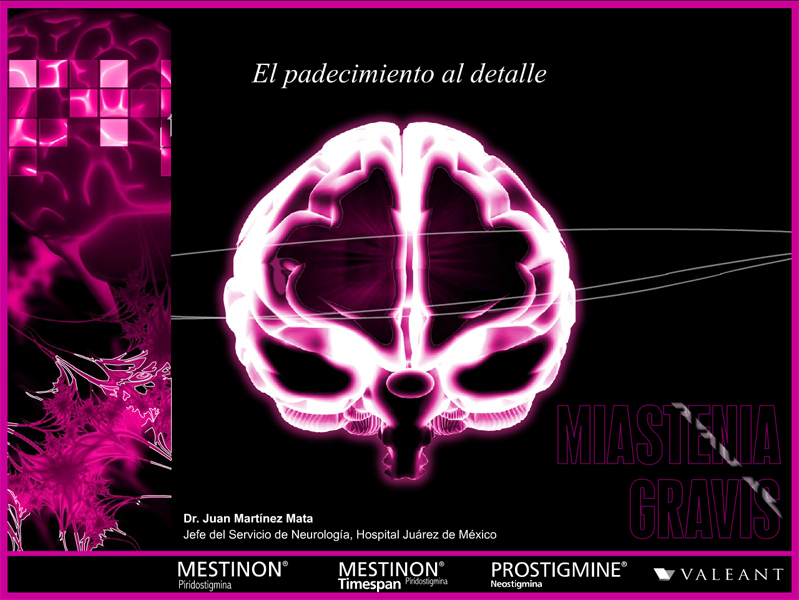 Miastenia Gravis - 1