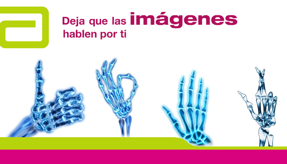 Alto a la progresión Radiográfica - 4