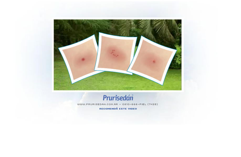 Si arde o pica - 2