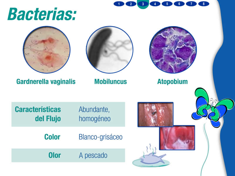 Gynoclin V Multimedia - 3