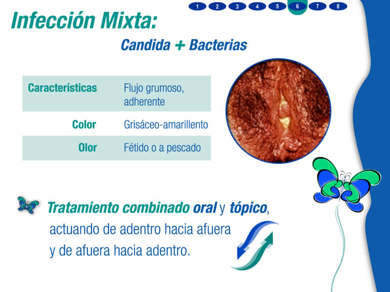 Gynoclin V Multimedia - 6