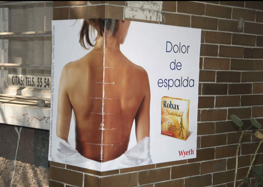 Espalda - 2