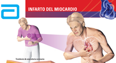 Cardio News