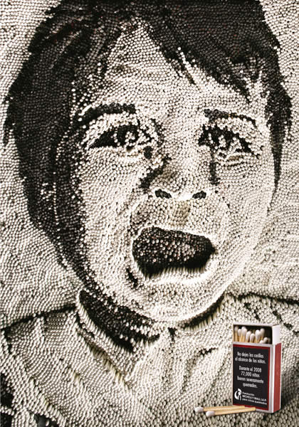 Niño Quemado - 3