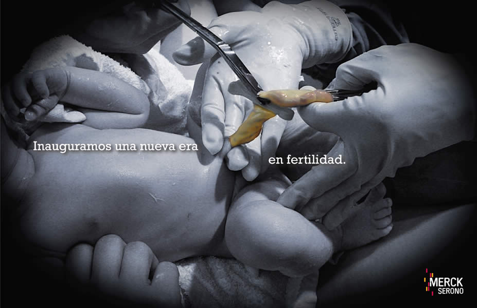 Fertilidad Cordon umbilical - 1