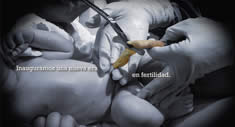 Fertilidad Cordon umbilical