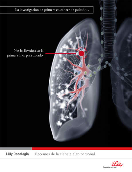 Pulmones - 1