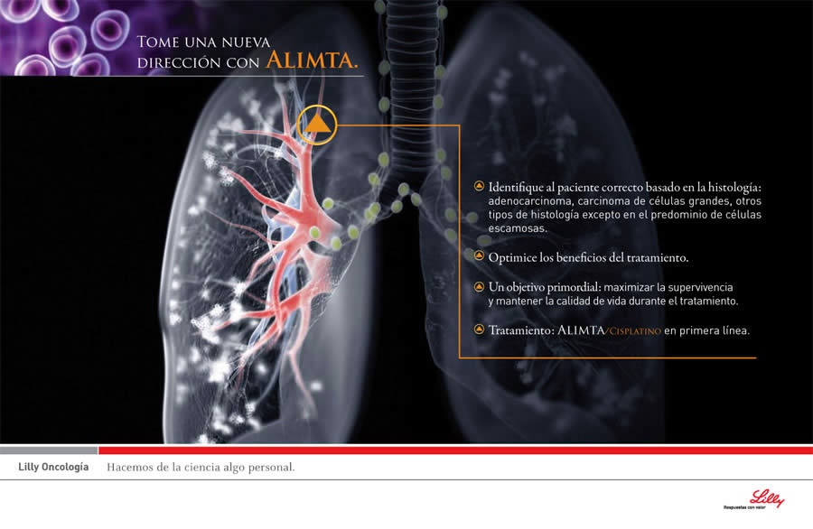 Pulmones - 3