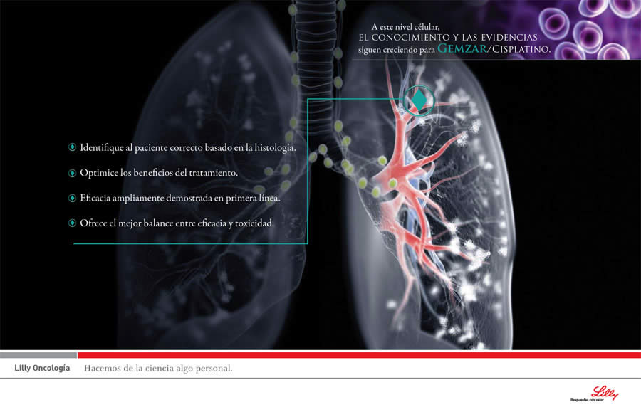 Pulmones - 6