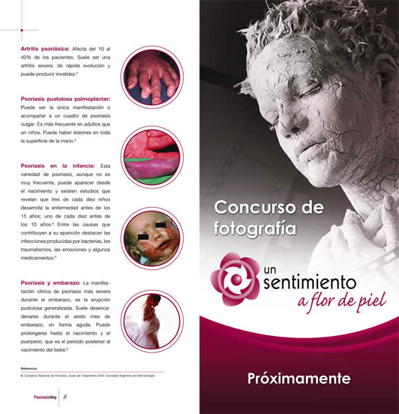 Revista Psoriasis hoy - 3