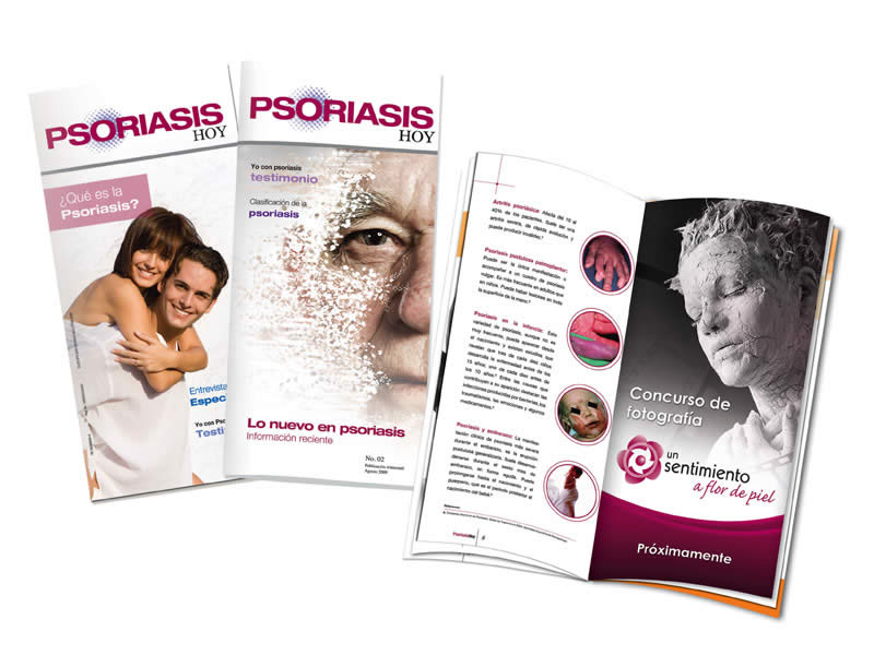 Revista Psoriasis hoy - 6