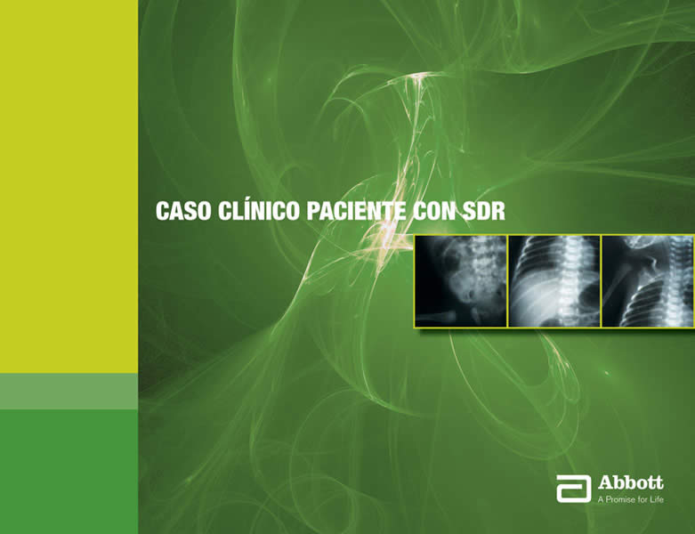 En SDR nacer por segunda vez - 7