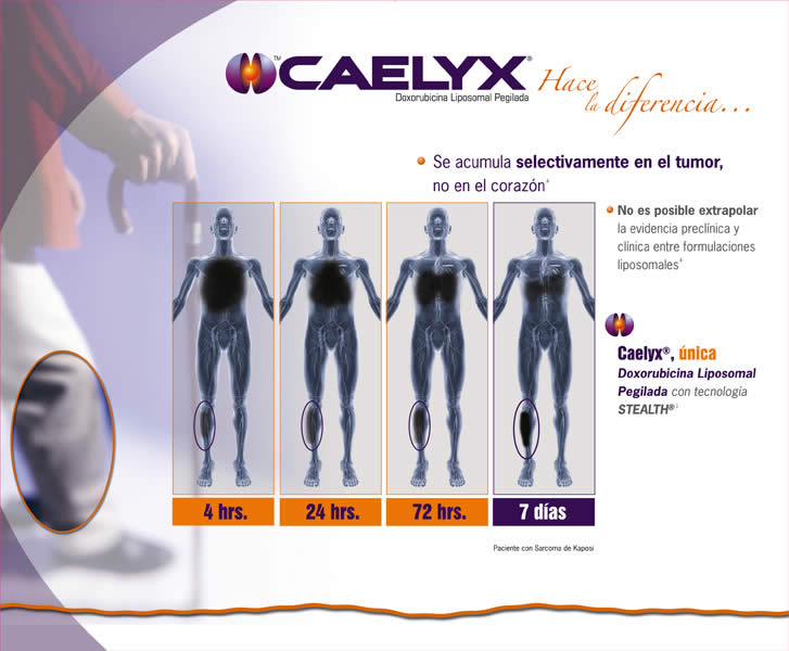 Única y totalmente diferente - 3