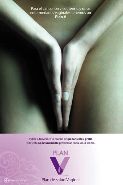 Manos en V - 1