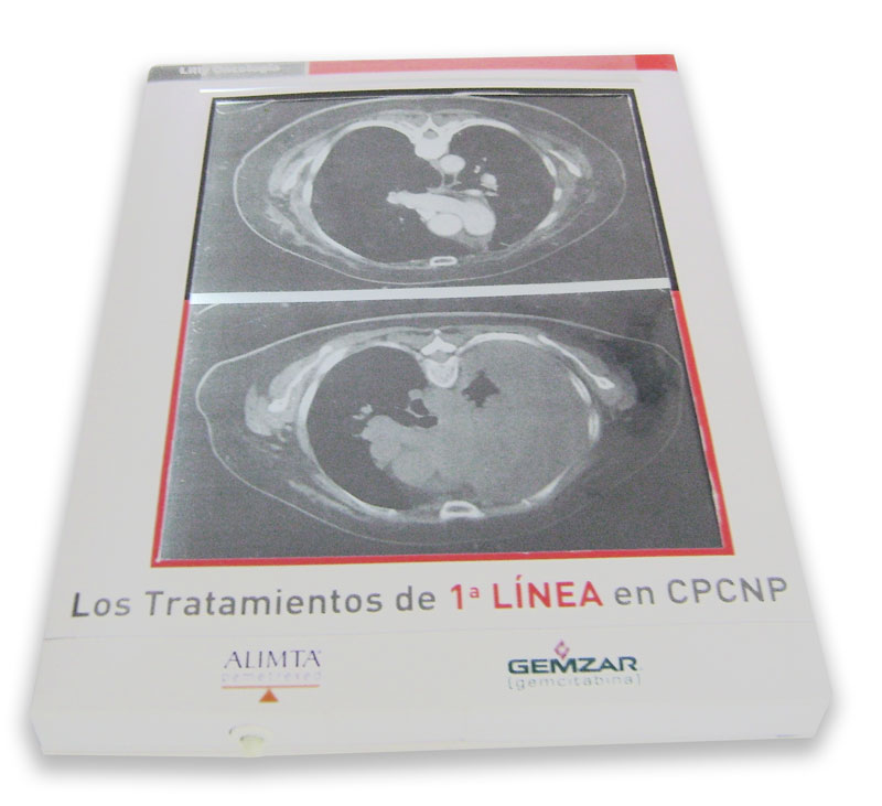Iluminando evidencias - 3