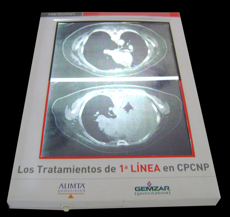 Iluminando evidencias - 4