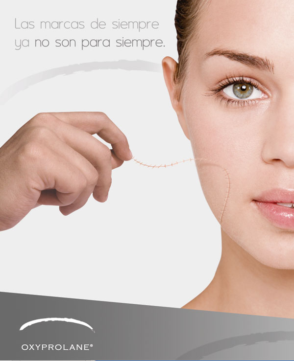 Cicatriz - 2