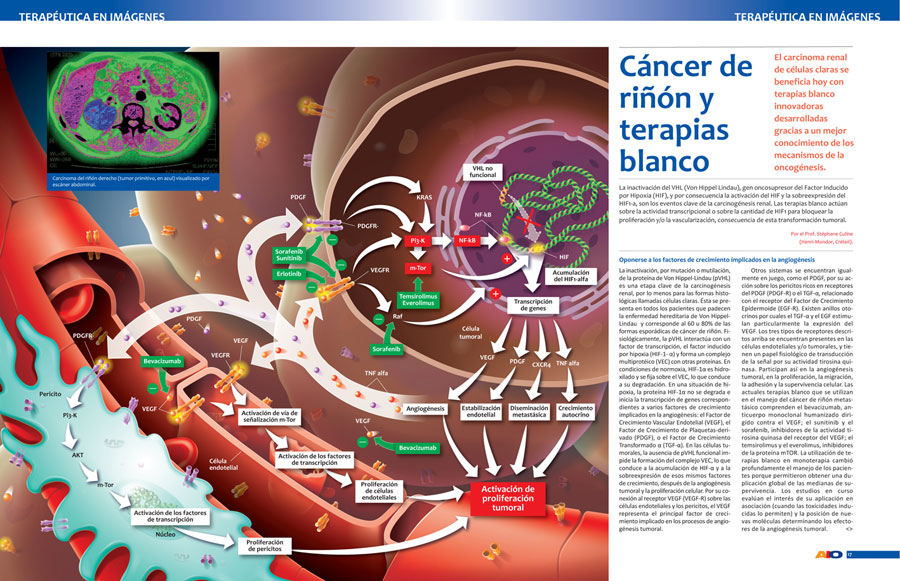 Actualidades e Innovaciones en Oncología - 1