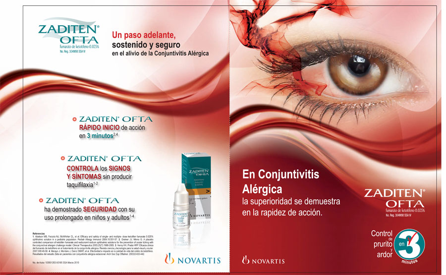 En conjuntivitis alérgica. - 2
