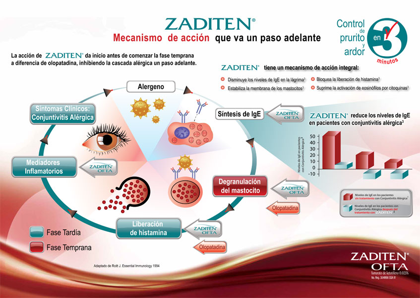 En conjuntivitis alérgica. - 3