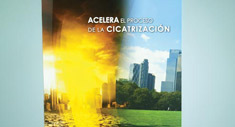 Ayuda Visual Recoveron