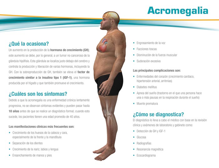 Evolución - 4