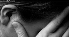 Descubriendo la Psoriasis