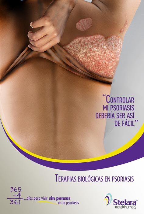Stelara 2012 - 2