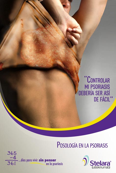 Stelara 2012 - 3