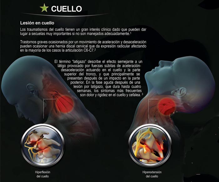 Forcedol Póster Traumatologia - 2