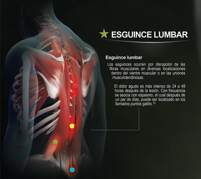 Forcedol Póster Traumatologia - 3