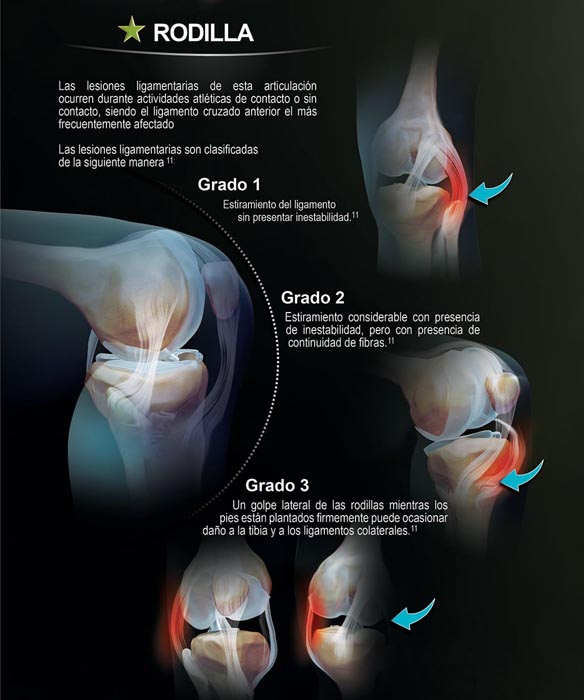 Forcedol Póster Traumatologia - 4