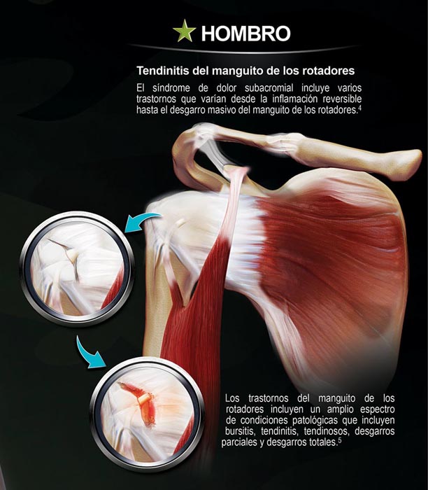 Forcedol Póster Traumatologia - 5